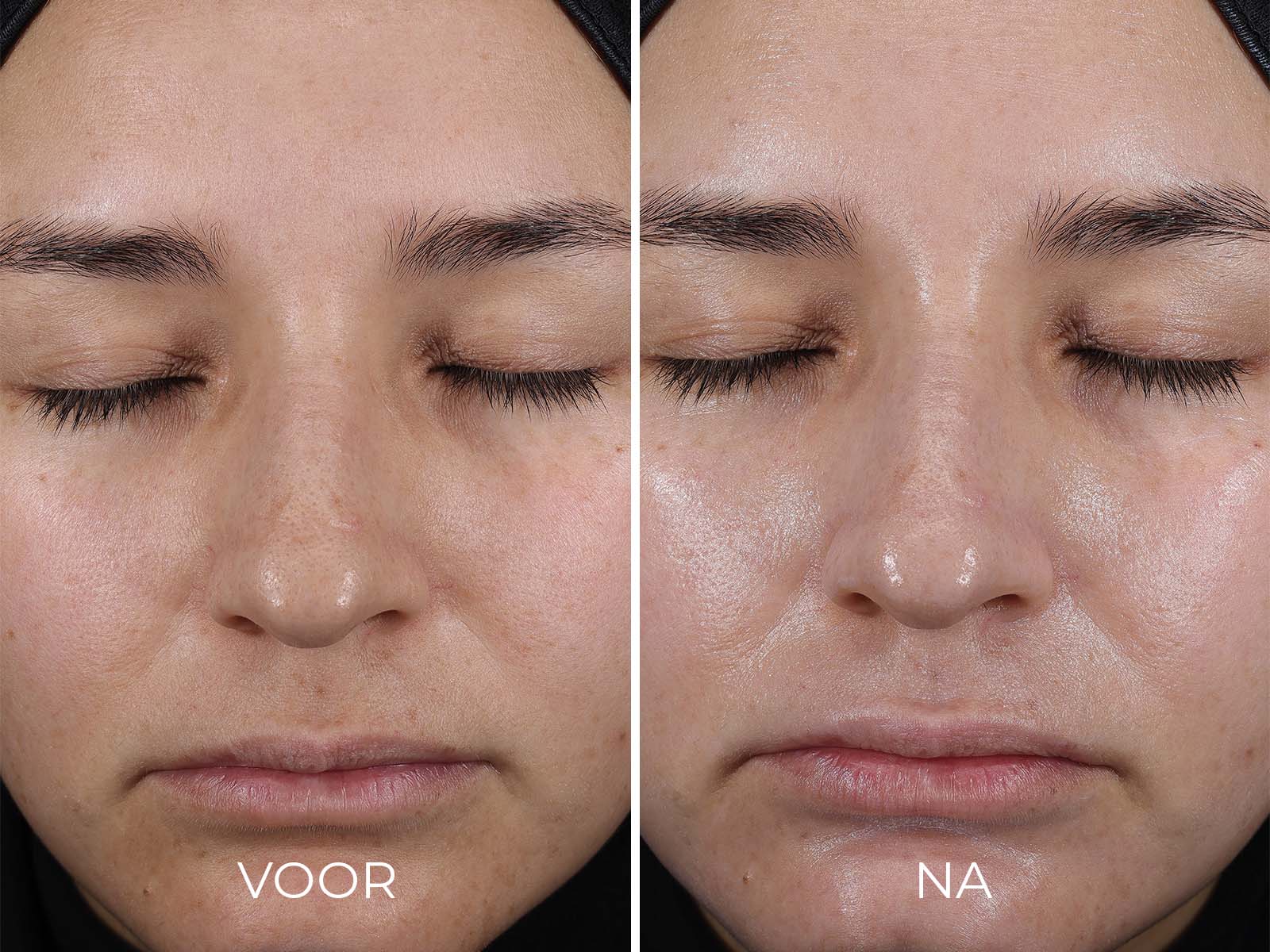 IMAGE Travel Pure Mineral Hydrating Moisturizer SPF 30 productdetail