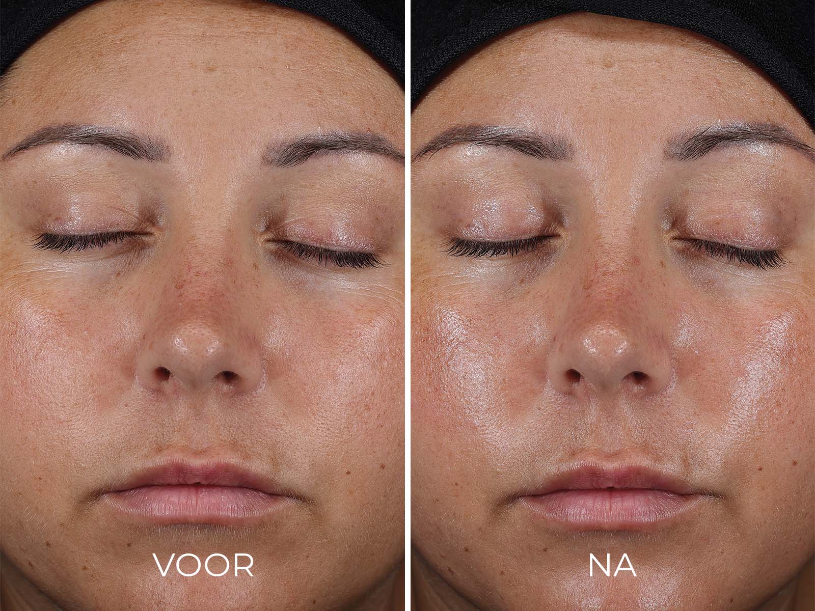 IMAGE Travel Size Ultra Defense Moisturizer SPF 50 productdetail