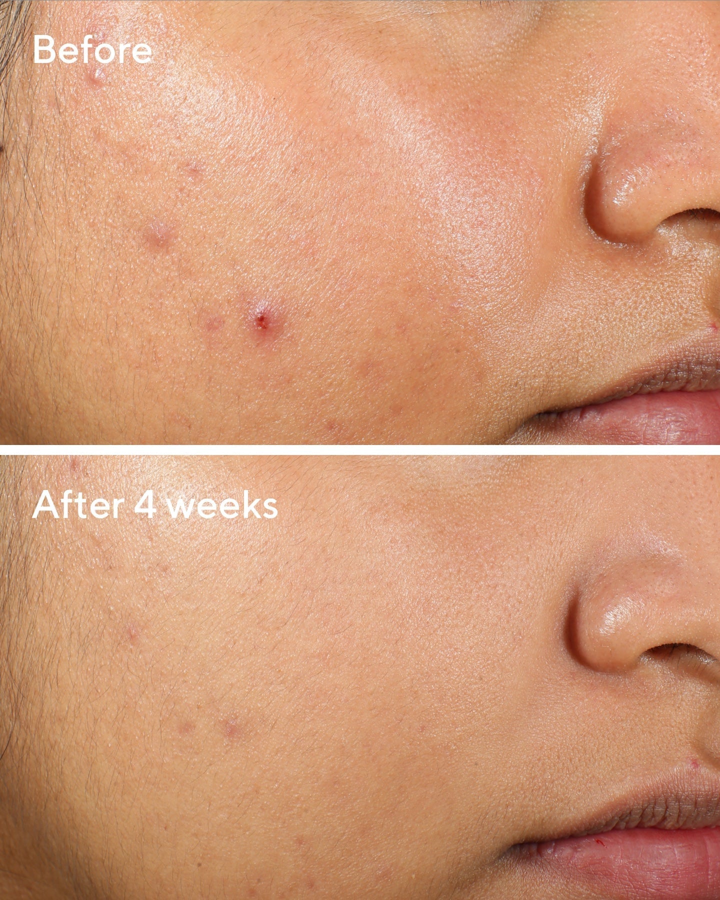 Murad Clarifying Water Gel verpakking