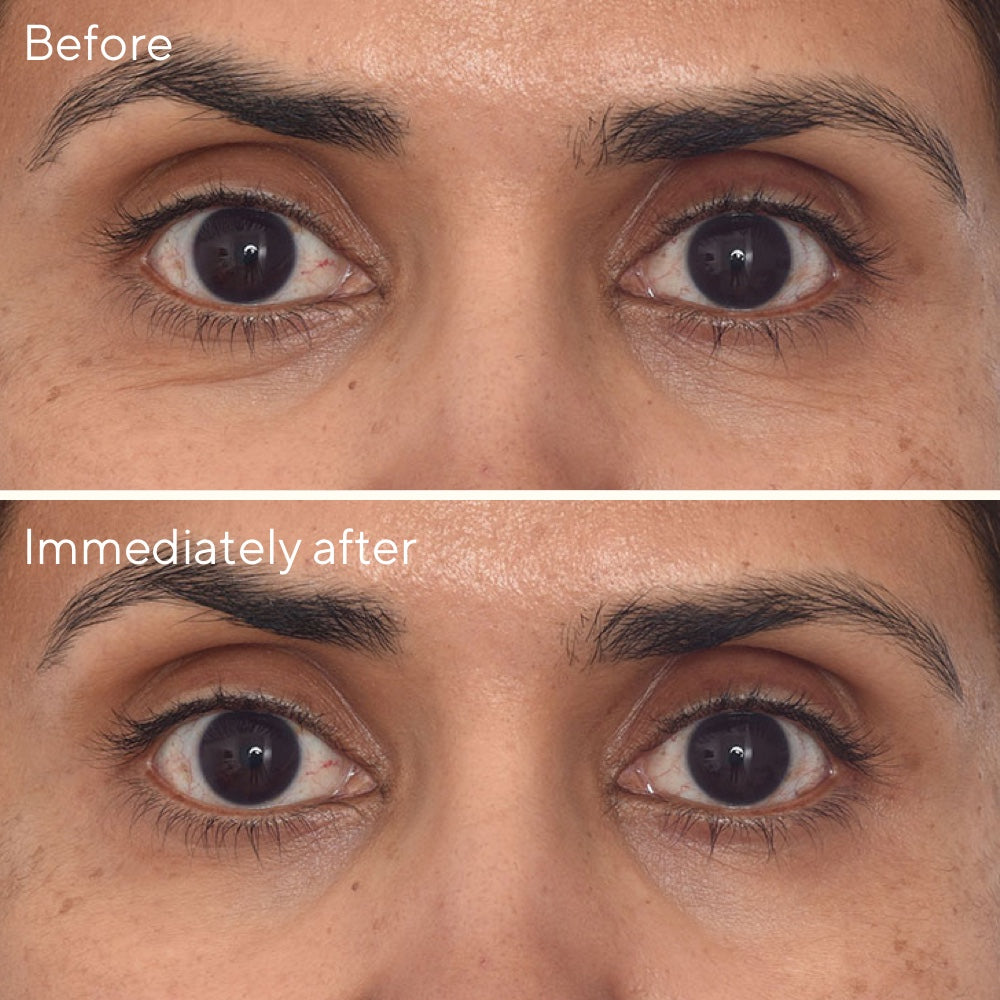 Murad Retinol Youth Renewal Eye Masks verpakking